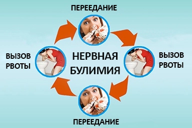 Лечение булимии в Яйве